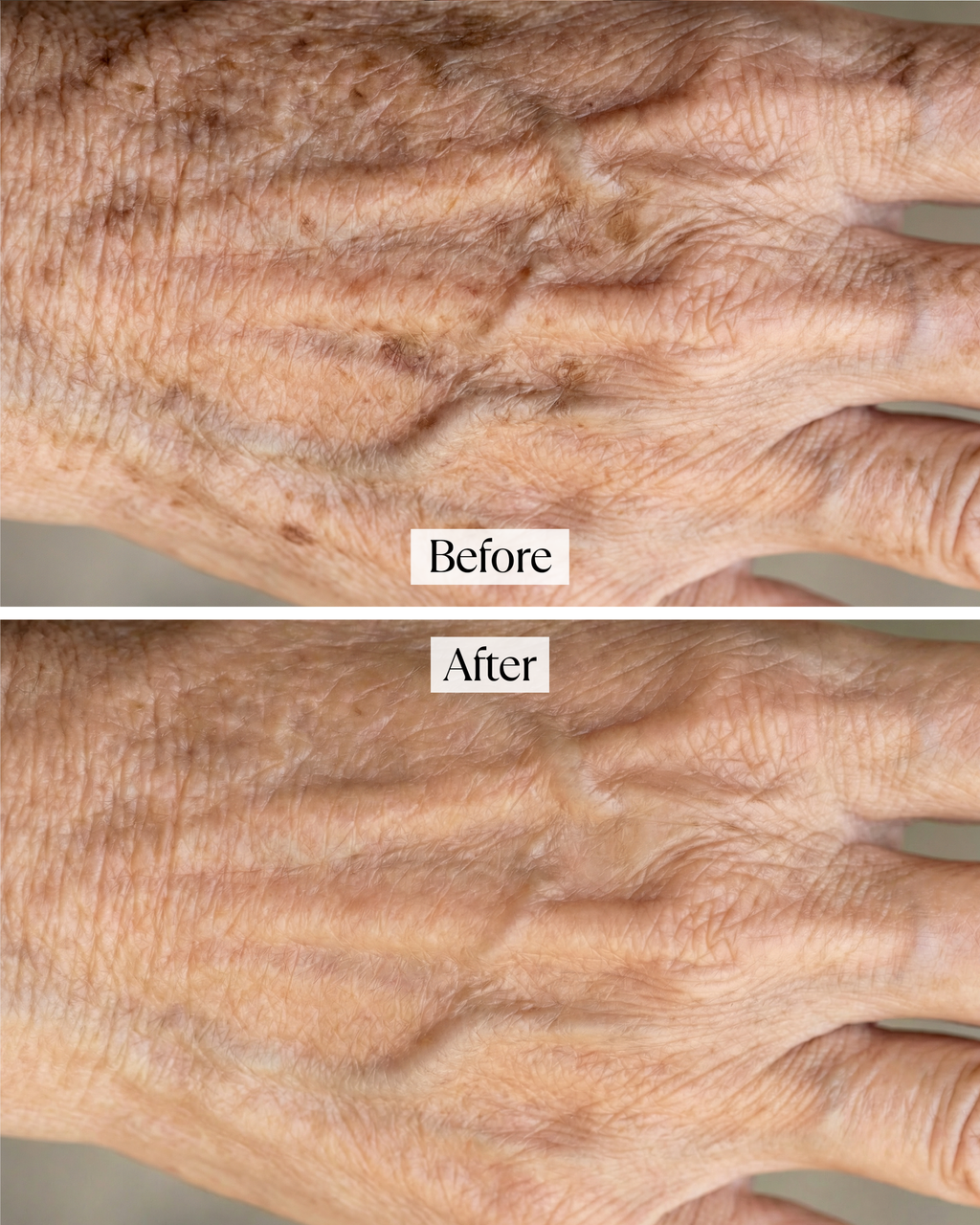 Revana Age-Revealing Hands Repair